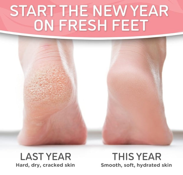 Pediluxe at Home Exfoliating Foot Peel- 2 pack