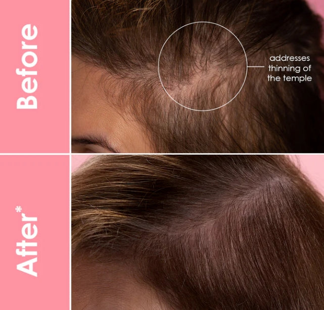 GrandeHair Enhancing Serum 40 ml