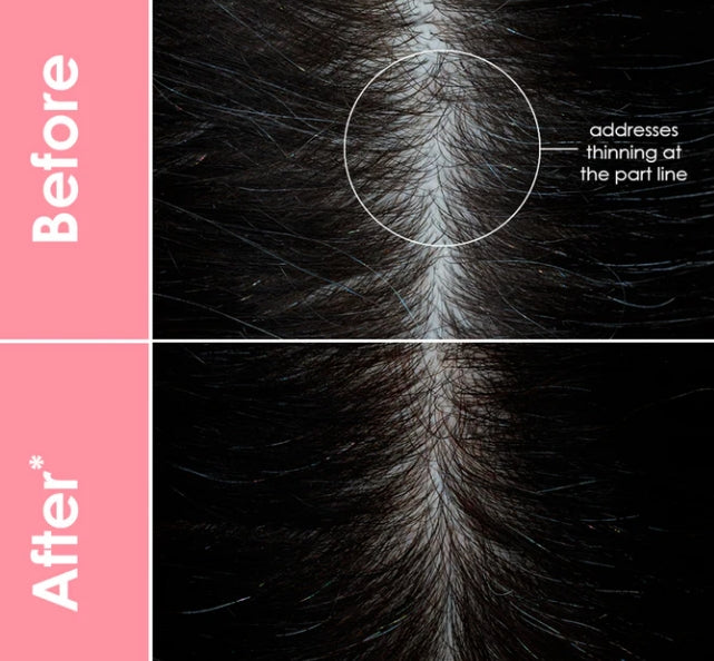 GrandeHair Enhancing Serum 40 ml